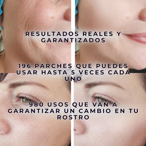 Dale años de vitalidad a tu rostro con Smoothing Face